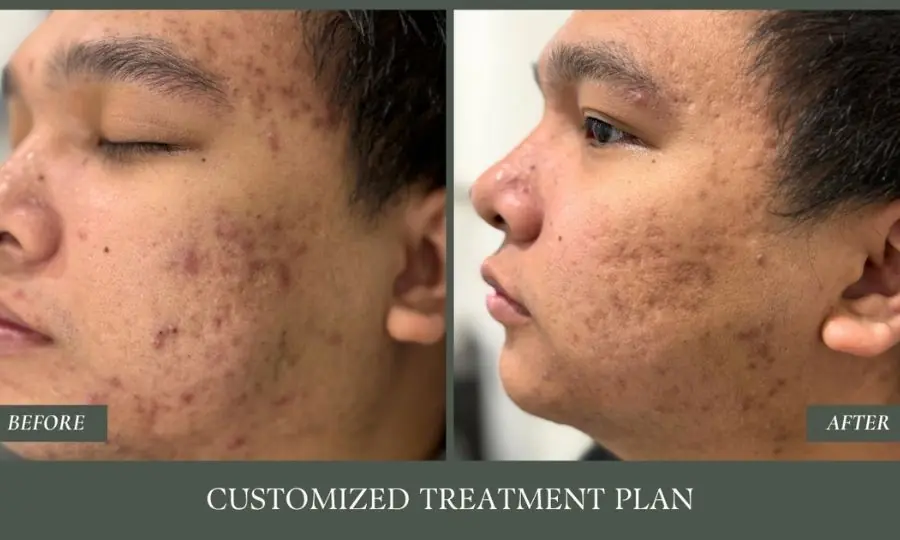Before and after: customized treatment plan.