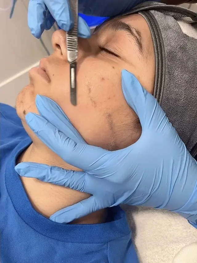 Which facial is right for your skin?