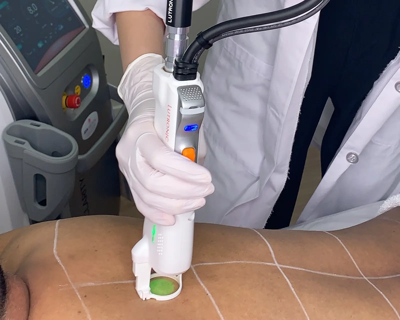 Which laser treatment do you need?