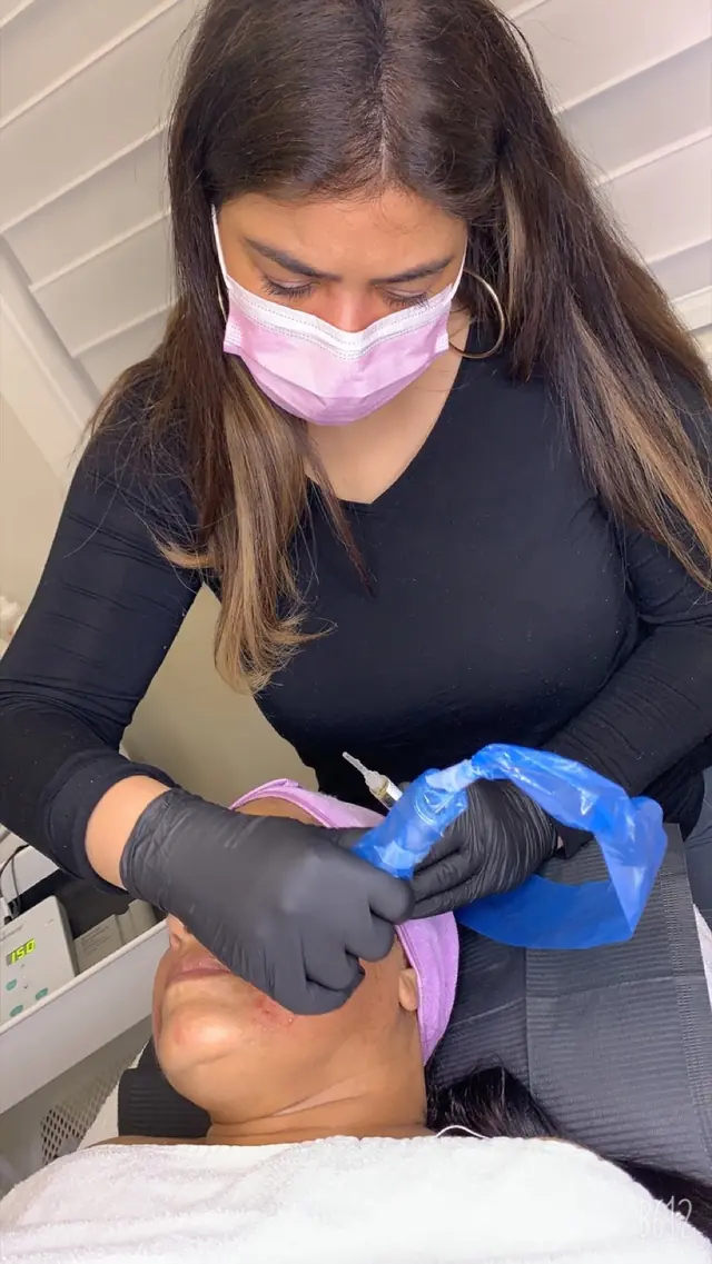 Microneedling or skin resurfacing?