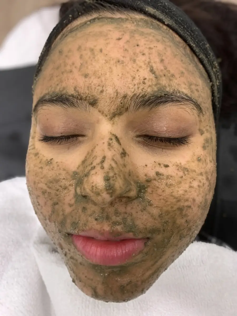 Which peel is right for you?