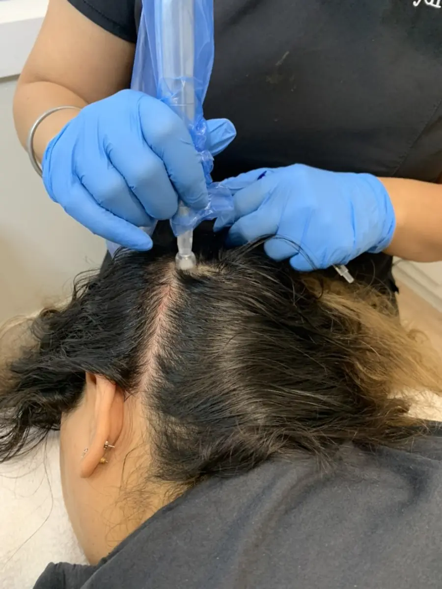 Which scalp treatment is right for you?