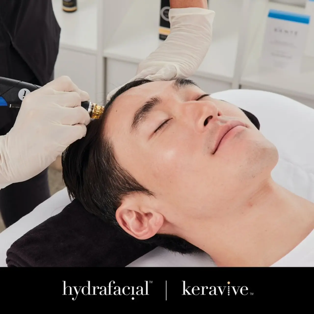 HydraFacial Keravive scalp treatment.
