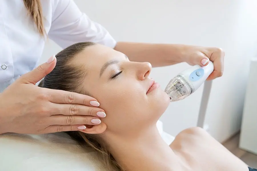 Microneedling for Acne in Surrey Safe Treatment for Clear Skin