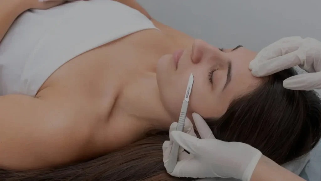 How Does Dermaplaning Work for Peach Fuzz Removal