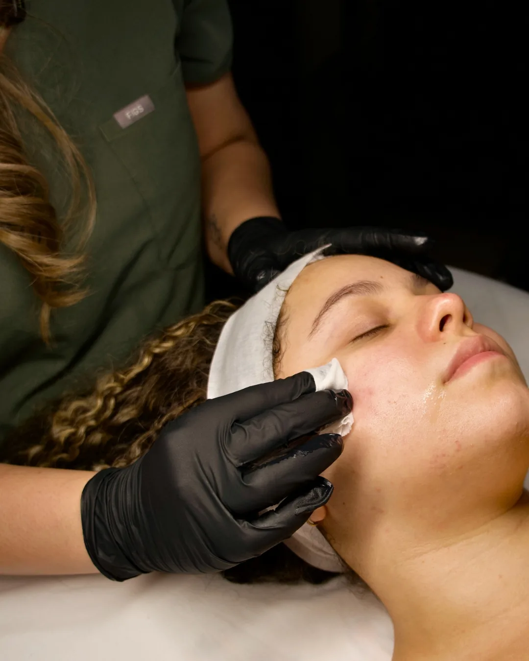 A chemical peel solution applied to a client’s cheek at Skinholic Aesthetics & Laser, Surrey.