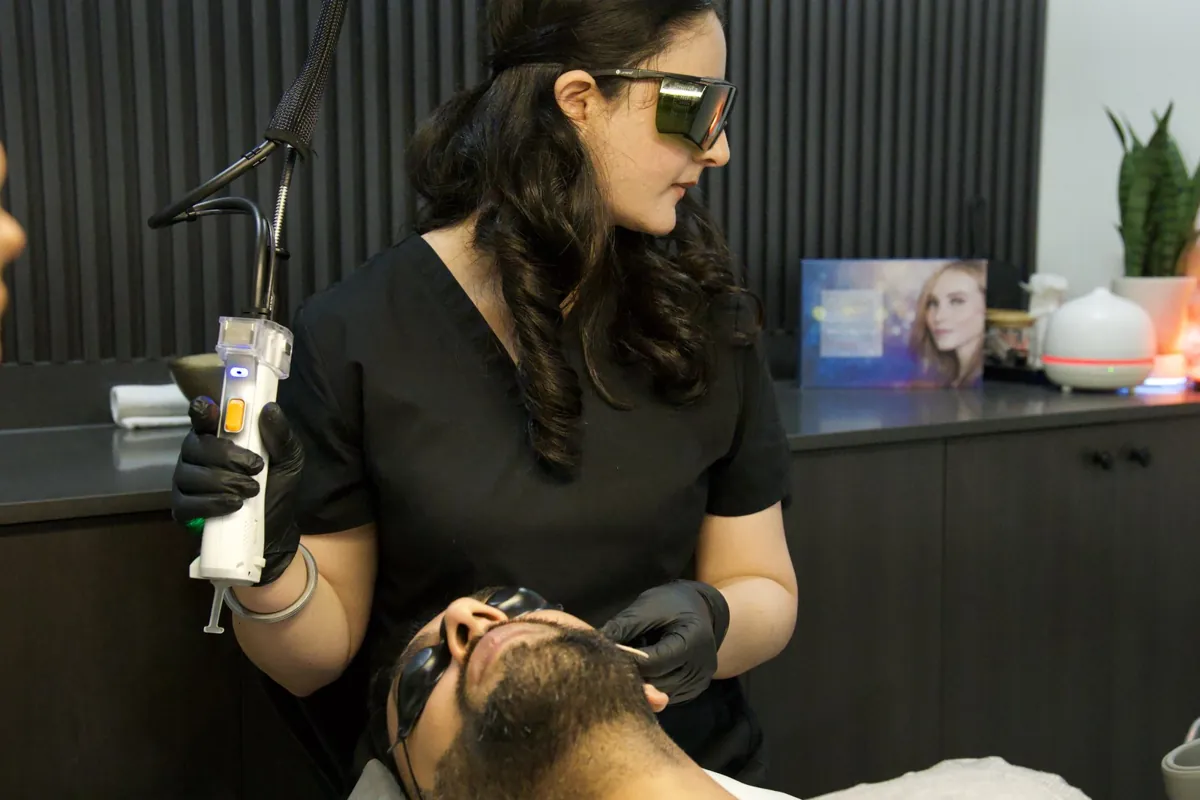 Laser beard sculpting at Skinholic Aesthetics & Laser, Surrey.