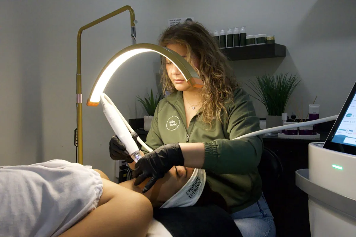 Potenza RF microneedling at Skinholic Aesthetics & Laser, Surrey.