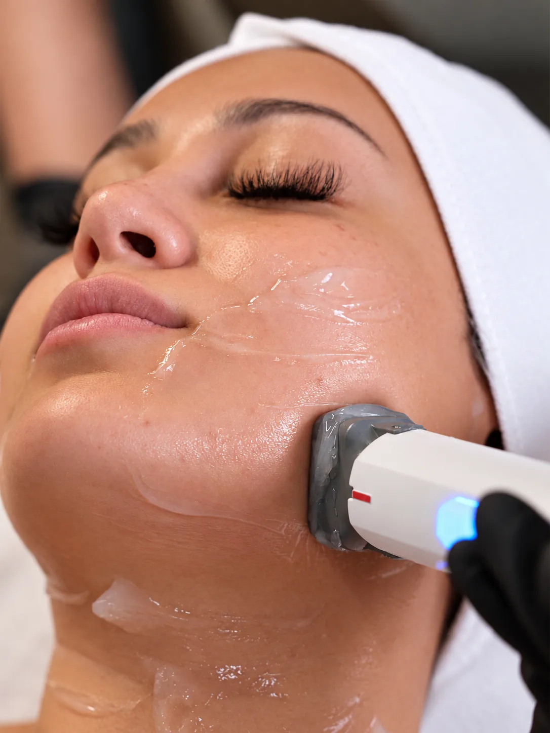 Close-up of a skin tightening handpiece with a blue light pressed to a woman's gel-coated cheek