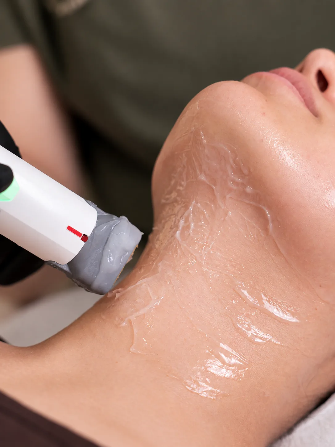 Close-up of a skin tightening handpiece moving over clear gel on a woman's neck below the jaw