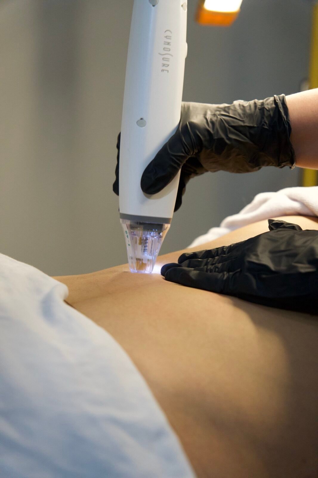 Personalised body treatment at the Skinholic clinic.