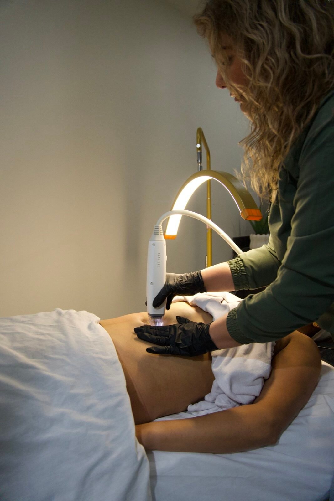 Stretch Mark Reduction