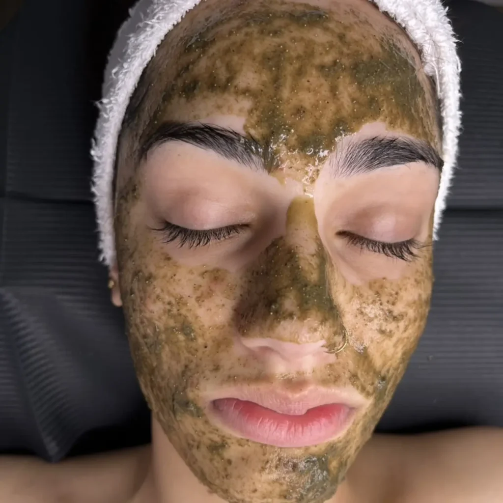 Which peel is right for you?